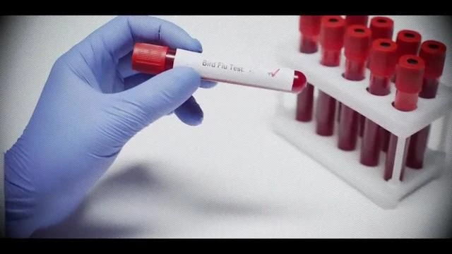All of this, is to bring a new control system. There is only a government virus